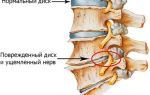 Боль в левом подреберье, ноющая, острая, тупая, колющая, тянущая боль в левом боку под ребрами сбоку, спереди, сзади – причины, лечение