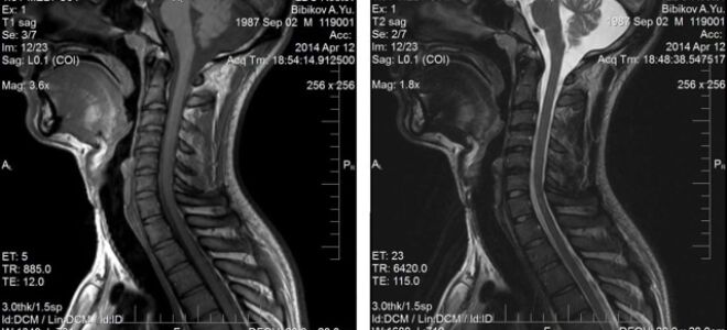 Что такое мрт с контрастированием
