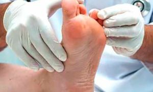 Эфирные масла от грибка ногтей на ногах: лучшие рецепты для лечения онихомикоза