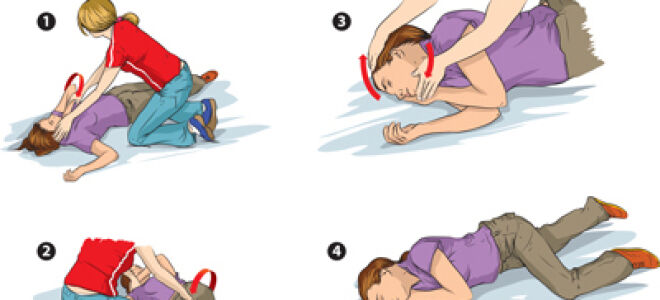 Обморок — причины, симптомы, лечение