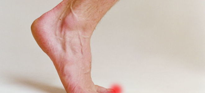 Мази от грибка на ногах – 10 лучших средств для лечения