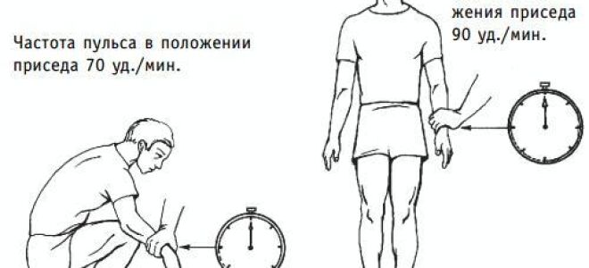 Нарушение мозгового кровообращения: симптомы и лечение