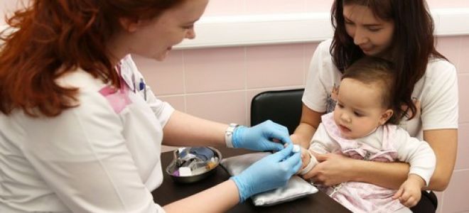 Антитела к лямблиям в крови: что такое iga, igm, igg