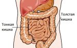 Катаральный колит кишечника: описание, причины, симптомы и лечение