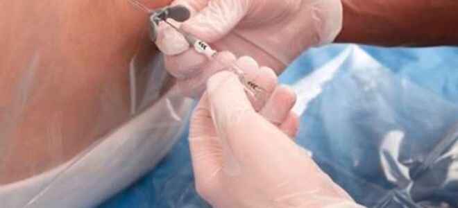 Боковой амиотрофический склероз (бас): причины, симптомы, лечение