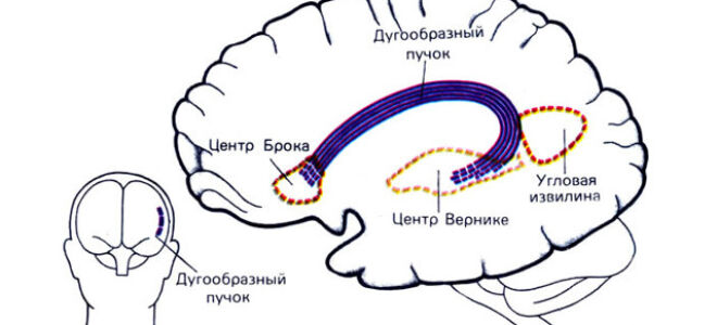 Домашняя реабилитация после инсульта: примеры, противопоказания
