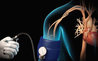 Резкое падение артериального давления причины