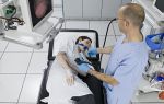 Гастроскопия во сне — как проводиться, цены, отзывы о процедуре