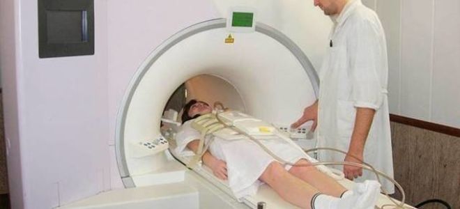 Головная боль: симптомы, причины и виды приступов