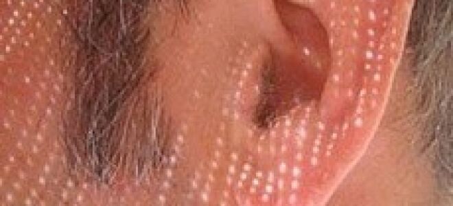 Болит голова и закладывает уши: причины, заболевания, диагностика, лечение