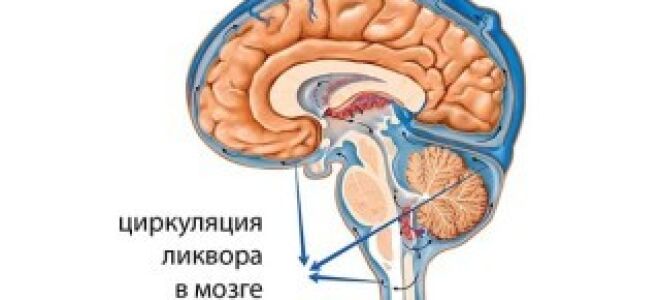 Как лечить внутричерепное давление у взрослых народными средствами