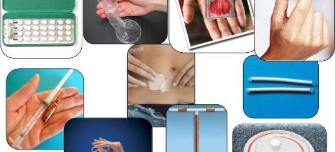 Кровотечение после аборта: сколько длятся кровяные выделения, причины возникновения после вмешательства