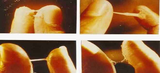 Выделения после незащищенного секса — ответы и советы на твои вопросы