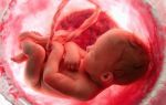Выделения после гексикона при беременности: норма и патология