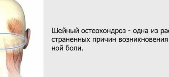 Болит висок с левой стороны: причины и лечение
