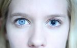 Один зрачок (один глаз) больше другого — причины у взрослых, лечение и профилактика