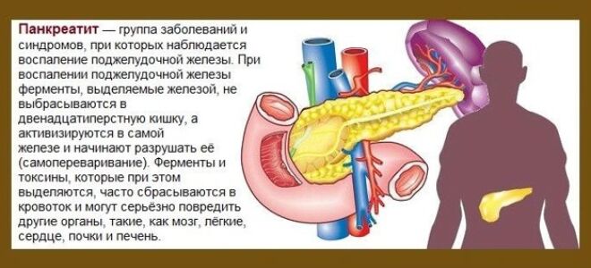Лечение поджелудочной железы в домашних условиях