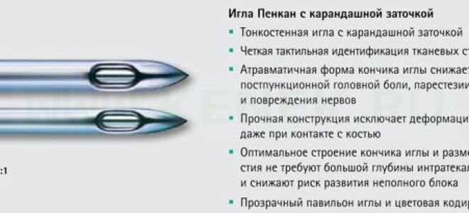 После наркоза болит голова: лечение после спинальной анестезии