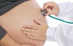Обильные выделения при беременности — основные причины