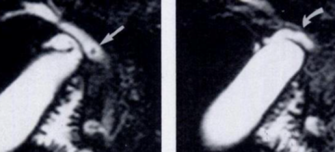 Может ли мрт ошибаться?