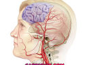 Инфаркт головного мозга – что это такое? ишемический, лакунарный, обширный инфаркт головного мозга – причины, симптомы, лечение и последствия