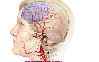 Инфаркт головного мозга – что это такое? ишемический, лакунарный, обширный инфаркт головного мозга – причины, симптомы, лечение и последствия