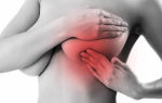 Набухла грудь: причины, признаки и способы лечения