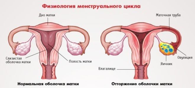 Месячные через 14 дней после предыдущих: основные причины