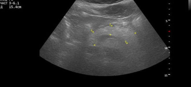 Узи поджелудочной железы: норма, расшифровка результатов, показателей