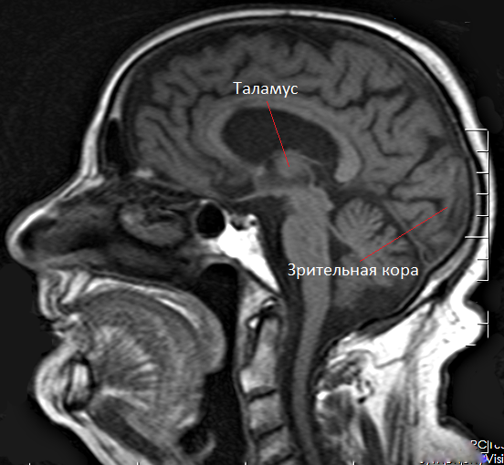 Что такое энцефалограмма головного мозга?