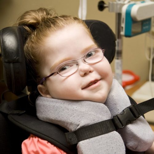 ДЦП у детей: синдромы, признаки и лечение детского церебрального паралича