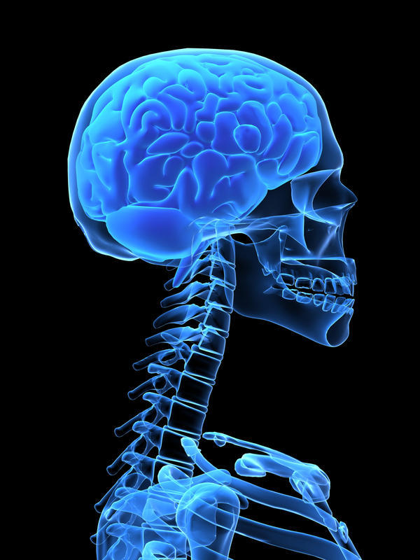 Субдуральная гематома головного мозга: последствия, симптомы, лечение