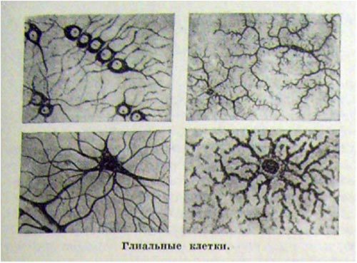 Глиоз белого вещества головного мозга: единичные и множественные очаги, признаки и прогноз жизни