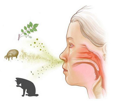 Чешется нос и постоянное чихание - причины и лечение 2019