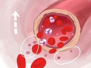 Норма тромбоцитов в анализе крови у женщин и беременных, причины отклонений