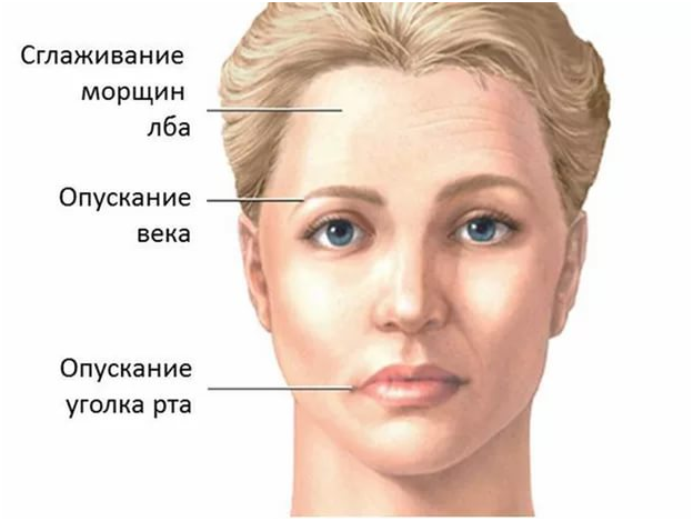 Застужен тройничный нерв симптомы лечения