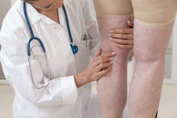 Диабетическая ангиопатия нижних конечностей: симптомы и лечение народными средствами