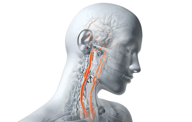 Боль в шее сбоку - причины, диагностика и лечение
