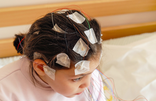 Эпилепсия у детей - причины, симптомы, диагностика и лечение