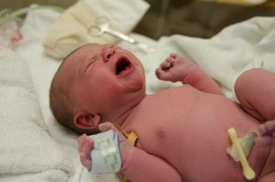 Кисти головного мозга у новорожденного: симптомы и лечение кистевых сосудистых сплетений и псевдокист, последствия и причины у грудничков