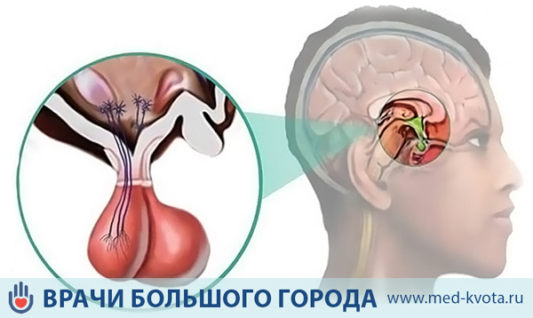 Симптомы опухоли гипофиза: лечение, причины, признаки рака мозга