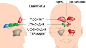 Лимфоузлы для уха, лечение и советы врачей