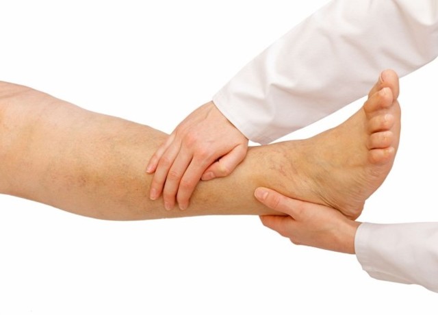 Диабетическая ангиопатия нижних конечностей: симптомы и лечение народными средствами