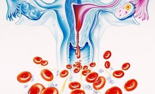 Маточное кровотечение при менопаузе: причины и лечение