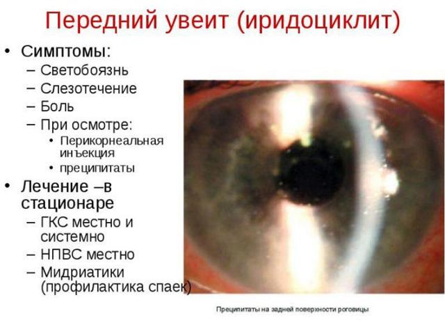 Капли для глаз при глаукоме - полный список с инструкциями, отзывы и цены на препараты
