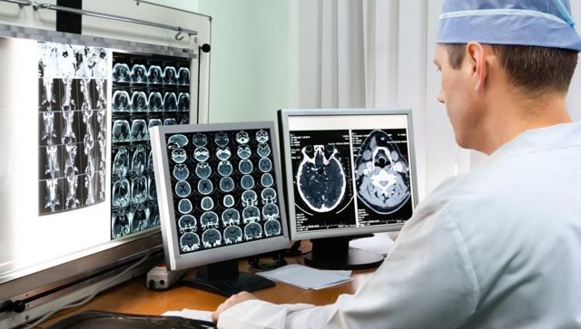 Как определить мигрень: диагностика (что покажет МРТ и ЭЭГ)