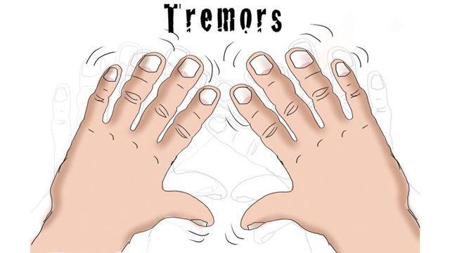 Тремор - симптомы, лечение, причины болезни, первые признаки