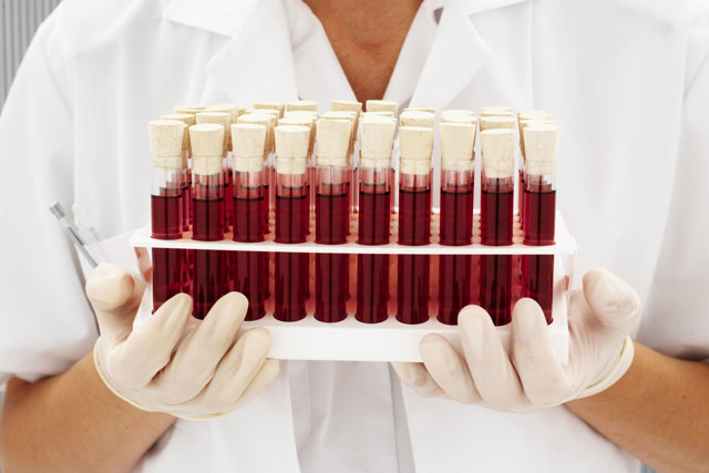 Как пишется и обозначается группа крови: резус-фактор, таблица, совместимость