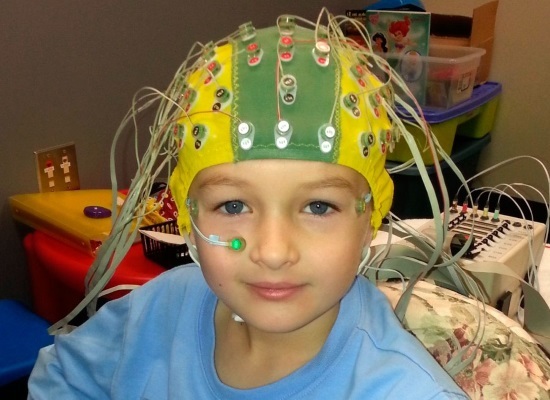 Расшифровка ЭЭГ у детей: норма и нарушения работы головного мозга