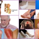 Почему немеют руки и ноги: 7 возможных диагнозов